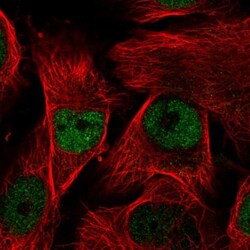 MORC2 Antibody, Novus Biologicals 0.1mL; Unlabeled:Antibodies, Polyclonal